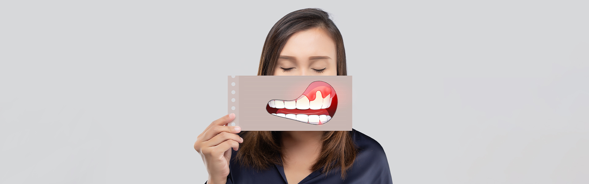 How Do You Cure Gum Disease Without Surgery?