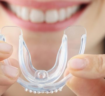 What Are The Benefits Of Using A Mouth Guard?